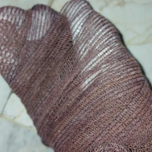 تصویر دست سوخته و باند پیچی شده من